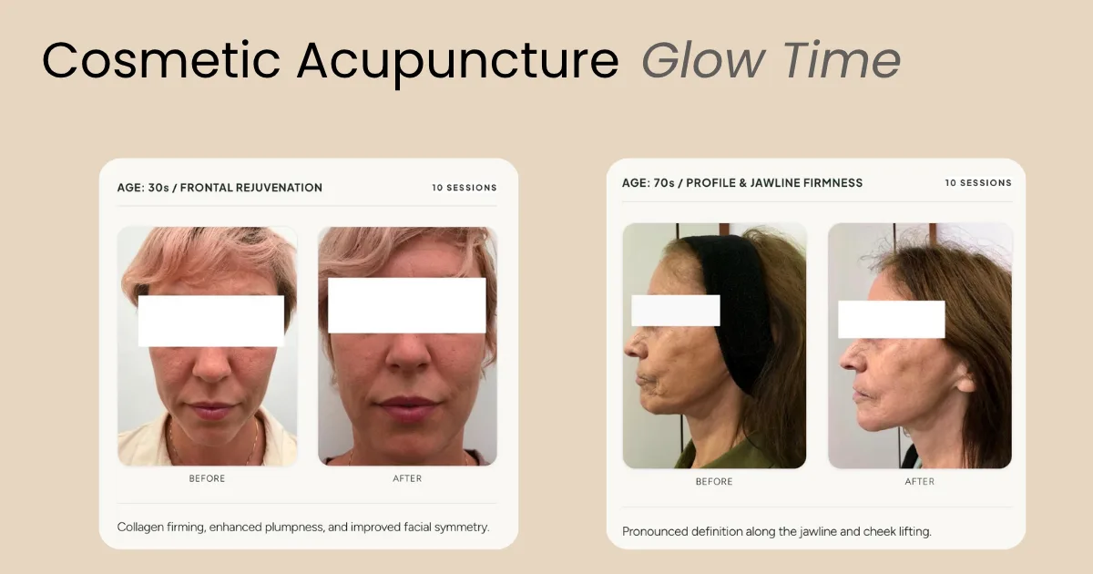 Acupuncture In Lisbon, foto 4